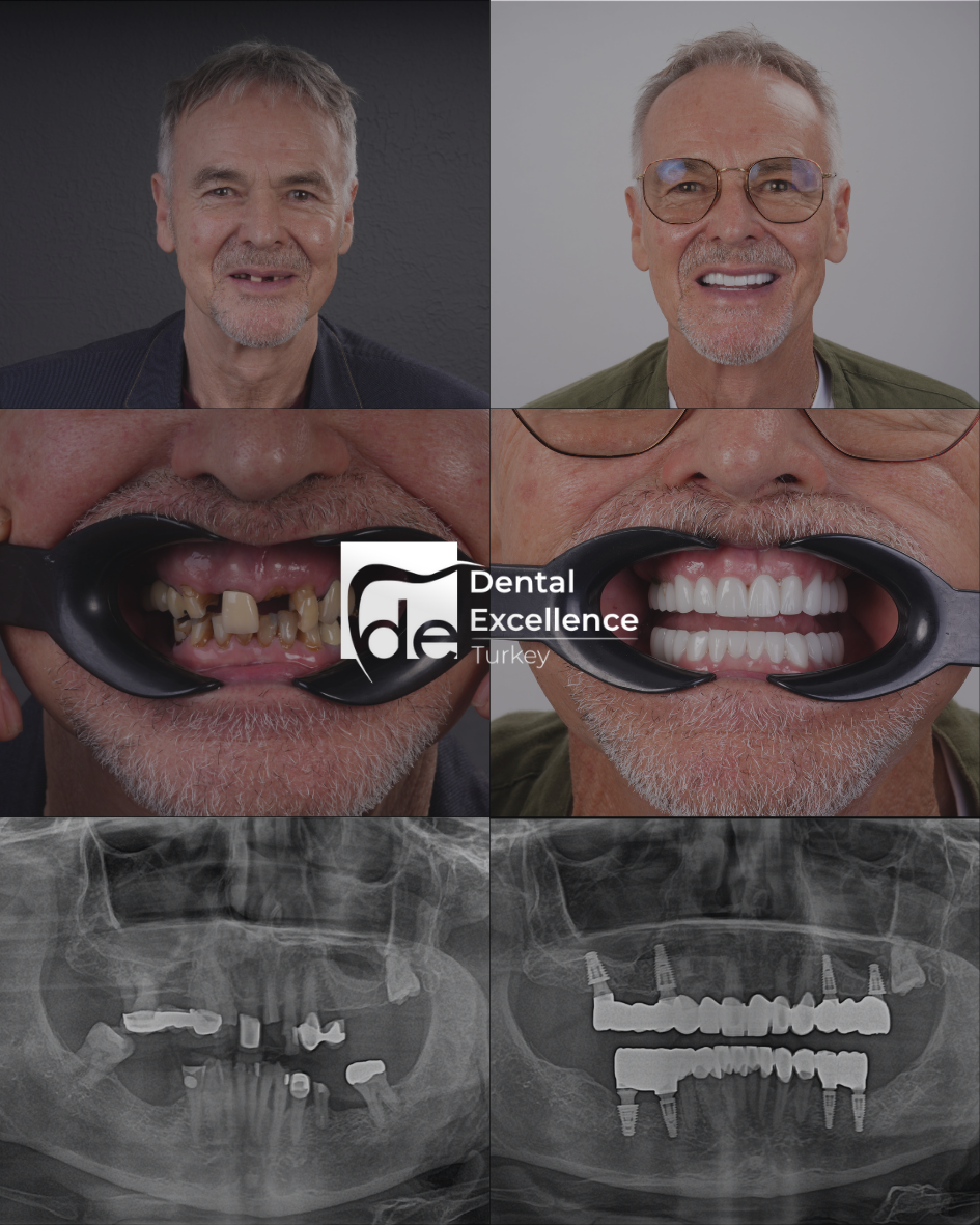 Before After Treatment