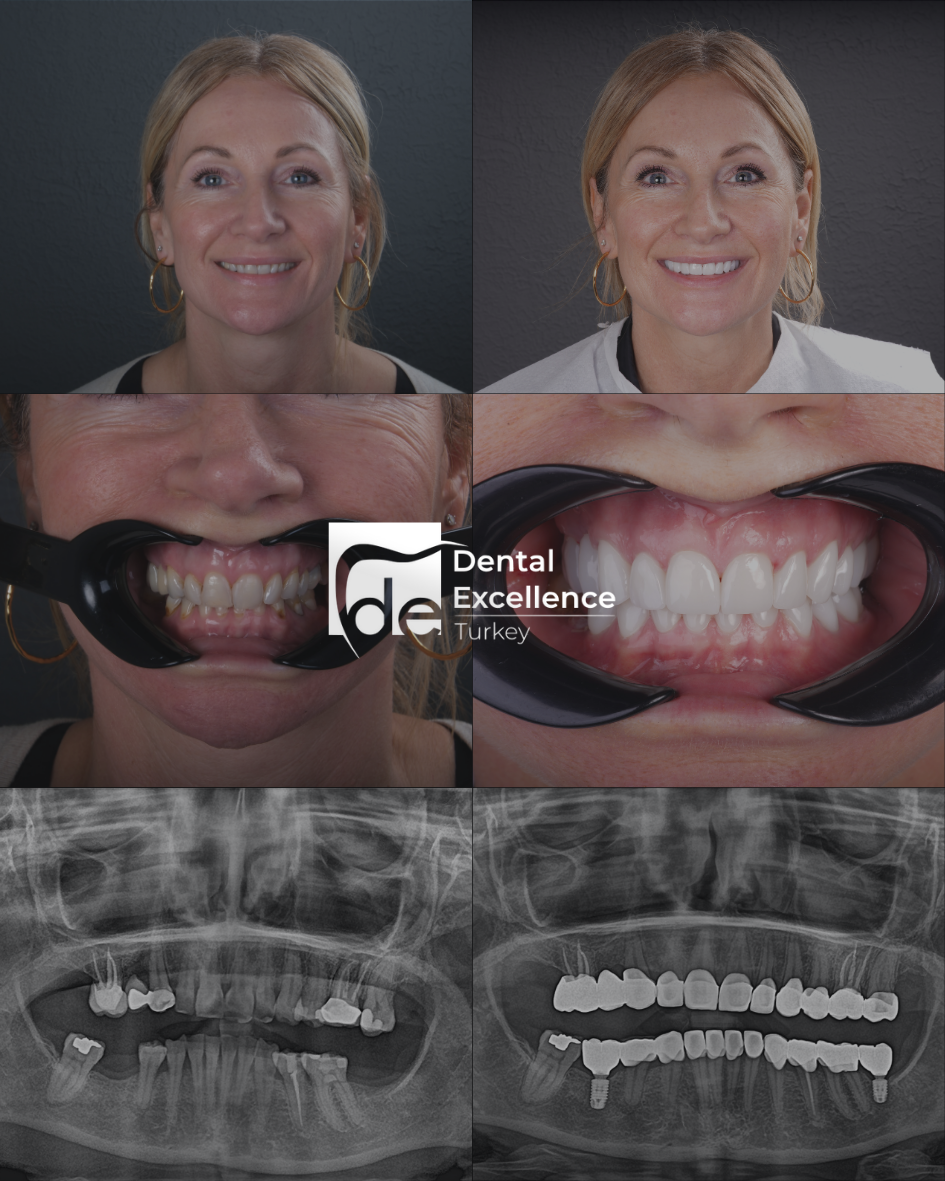 Before After Treatment