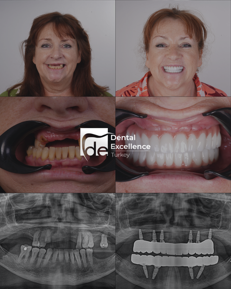 Before After Treatment