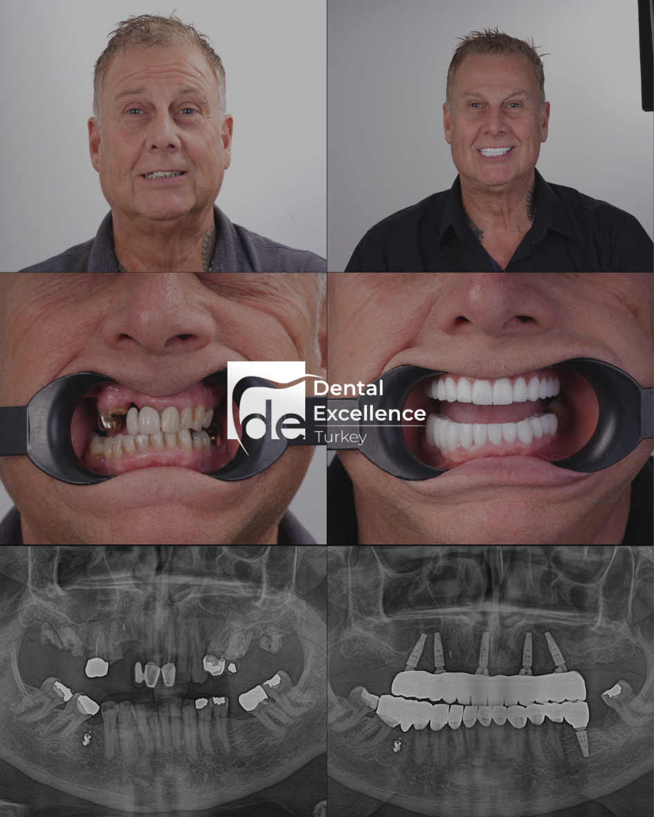 Before After Treatment